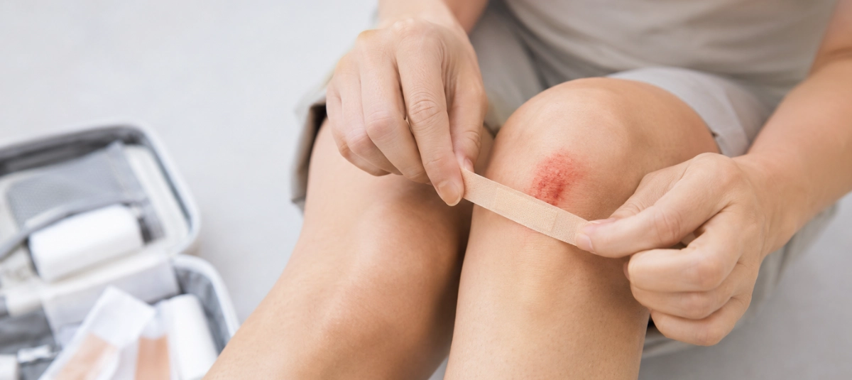 Como Curar Raspones ¿Qué hacer ante cortes, raspones y hemorragias para evitar infecciones ...