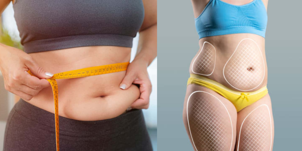 Cintura Grasa Visceral Pasos Para Perder Grasa Abdominal Exceso De