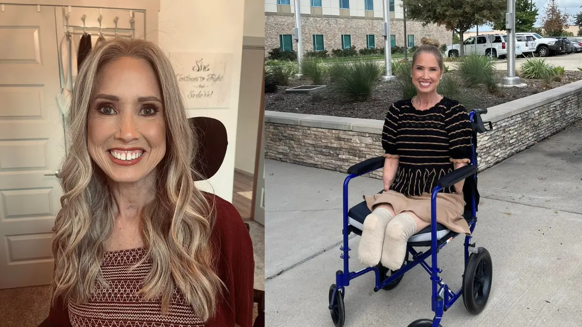 A maestra le amputan pies y manos después de un dolor de garganta que le  provocó sepsis