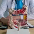 El cáncer colorrectal puede confundirse con problemas digestivos.