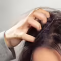 La picazón en el cabello se debe a diversas razones