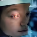 ojos