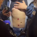 Manifestantes y policías heridos tras disturbios en marchas en Lima, Perú.