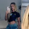 Olivia Oras, influencer finlandesa, murió luego de someterse a una cirugía estética: tenía 27 años