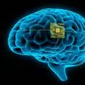 cerebro