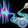 osteoporosis