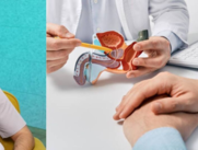 cáncer de próstata.