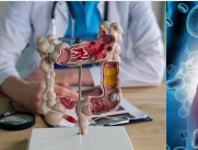 El cáncer colorrectal puede confundirse con problemas digestivos.