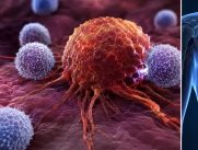 Cáncer