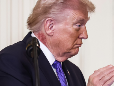 Donald Trump fue visto con un sarpullido en el cuello.