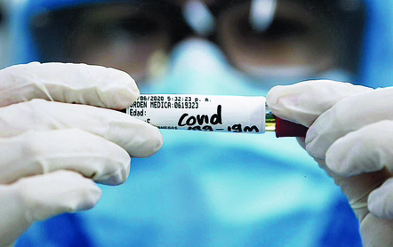 Pruebas de covid-19 en el Laboratorio de Microanálisis Integral ubicado en la Clínica Versalles de Cali.