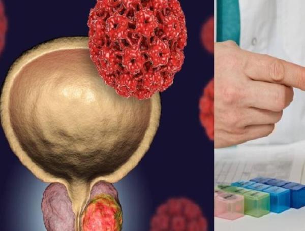Los siete síntomas del cáncer de próstata que no debe ignorar: dolor al ...