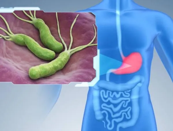 Esta bacteria crece en el sistema digestivo y suele adquirirse en la infancia.