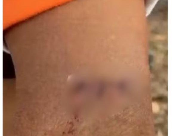 Nardeli fue arañado por el felino durante el forcejeo.