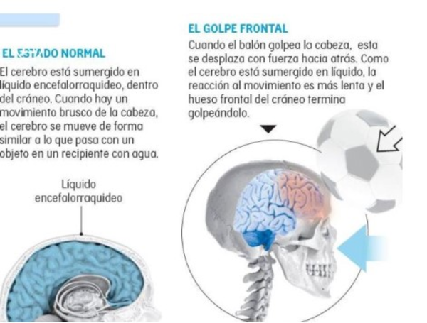 Golpes con la cabeza en el deporte