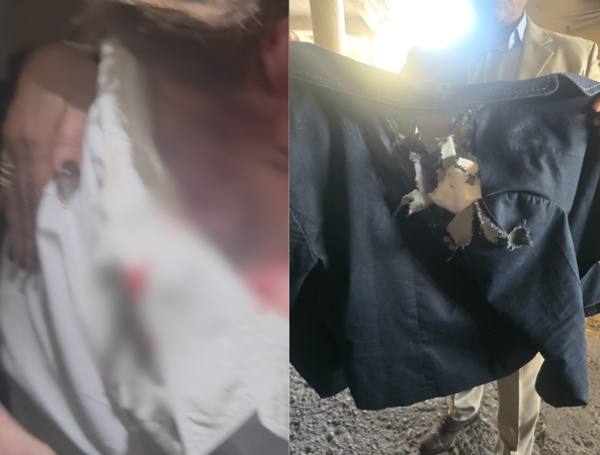 La diputada tiene graves quemaduras y su ropa quedó destruida.