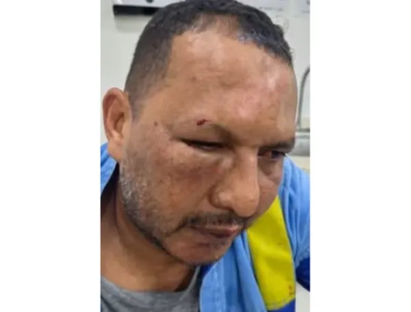 Funcionario de Air-e fue agredido durante un procedimiento