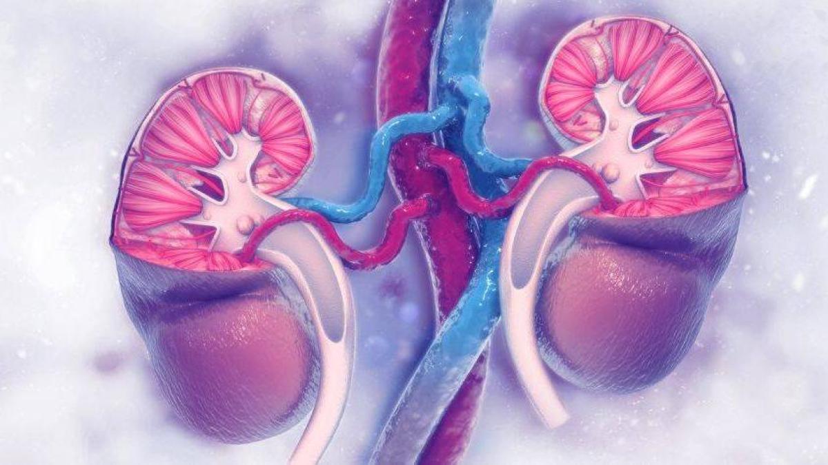 Si consume esta vitamina, puede provocar cálculos en los riñones: cómo ...