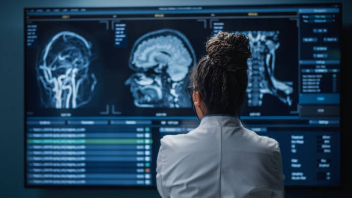 Nuevo análisis de sangre podría facilitar la detección y seguimiento de un tipo de tumor cerebral