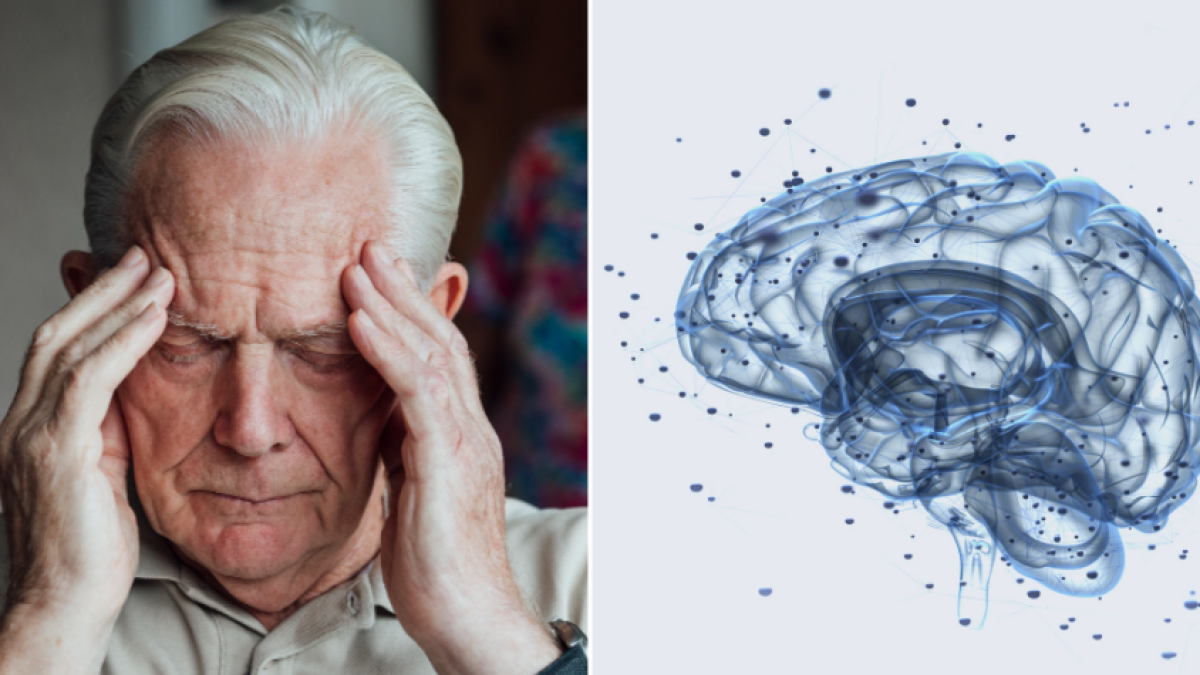 Estimulación magnética cerebral podría frenar el avance de la demencia