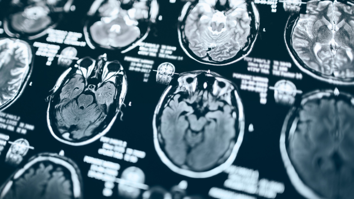 Científicos identifican el circuito cerebral que define si seguimos un plan fallido o cambiamos de estrategia