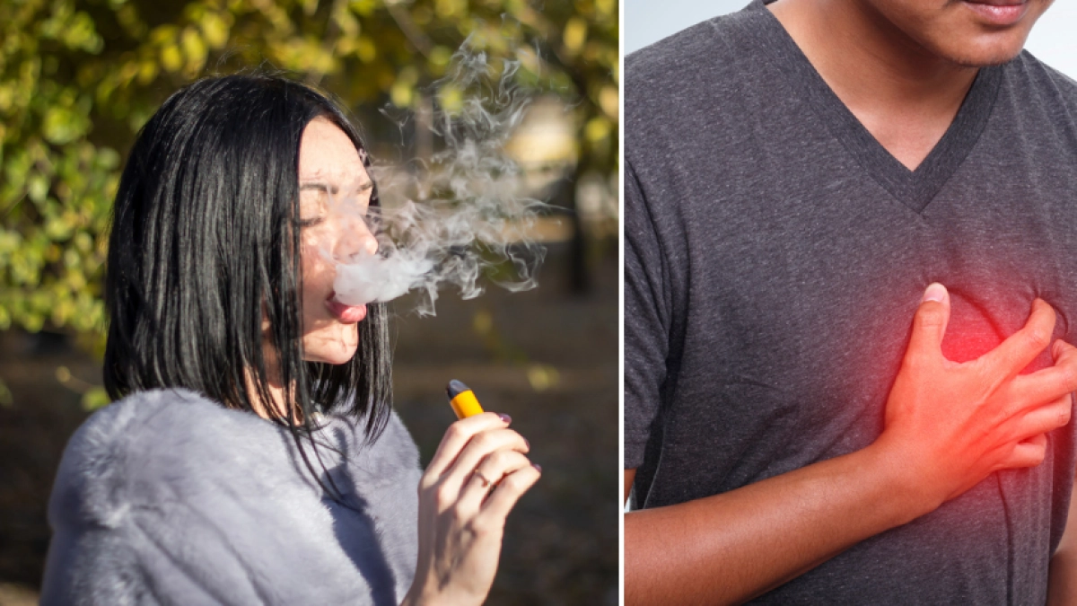 Liga Contra el Cáncer advierte que vapeadores podrían causar EPOC y graves enfermedades pulmonares