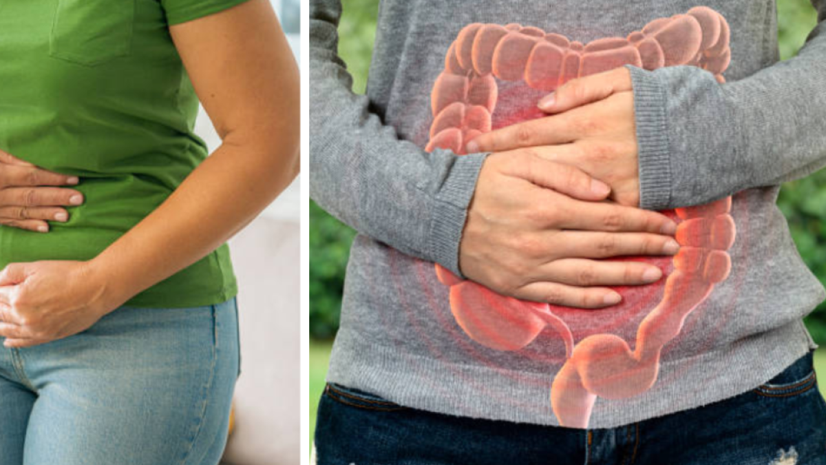 Cuatro síntomas que los cirujanos advierten no ignorar para detectar a tiempo el cáncer de intestino y no confundir con estreñimiento