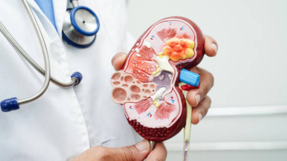 Los 9 alimentos que aumentan el riesgo de piedras en los riñones y cómo reemplazarlos