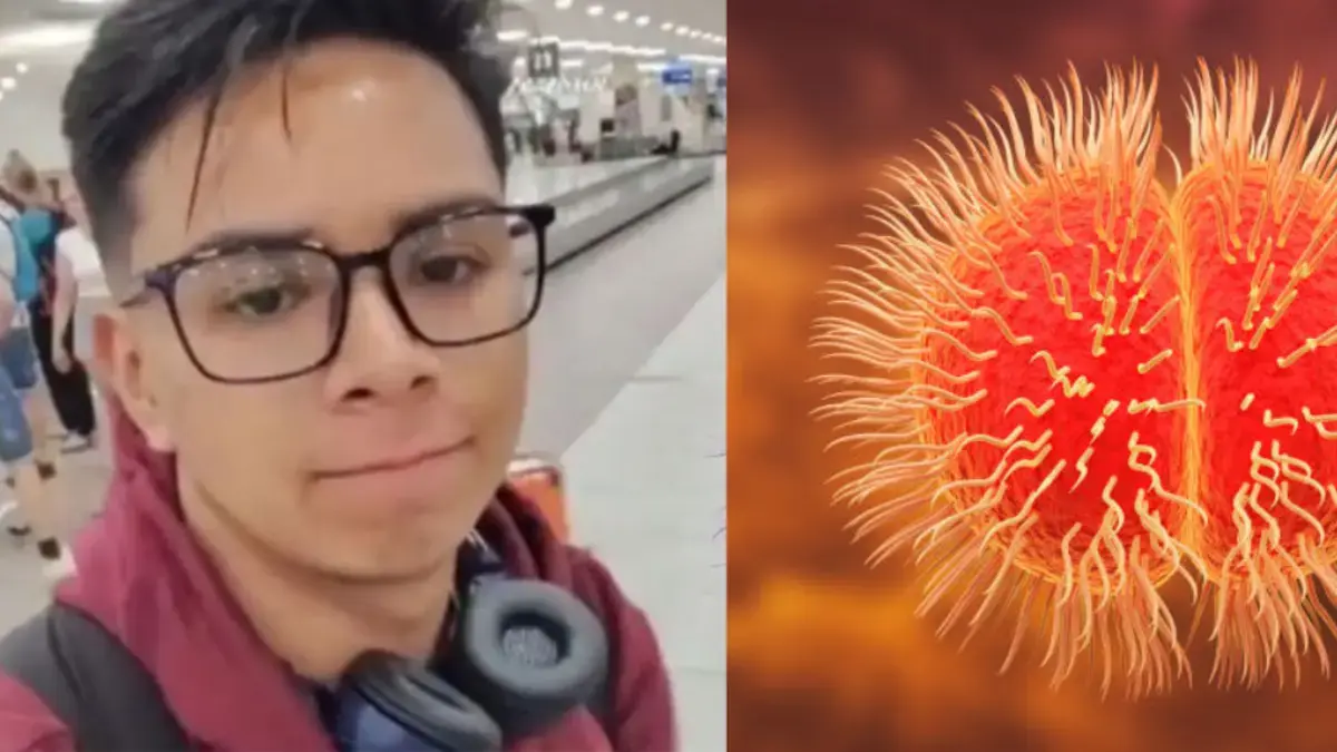 Joven se fue de intercambio y perdió la pierna luego de contraer una peligrosa bacteria