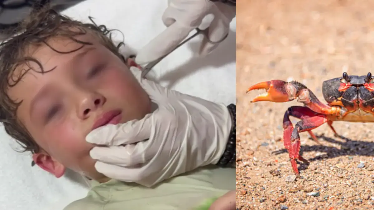 Video | Le sacan un cangrejo del oído a niño tras pasar un día en la playa
