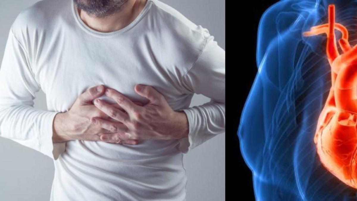 Cuatro factores de riesgo que causan casi todos los infartos y accidentes cerebrovasculares, según expertos