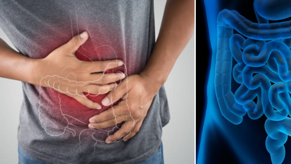 Cáncer colorrectal en menores de 50: identifican un síntoma que no debe ignorarse y que detecta las fases iniciales de la enfermedad
