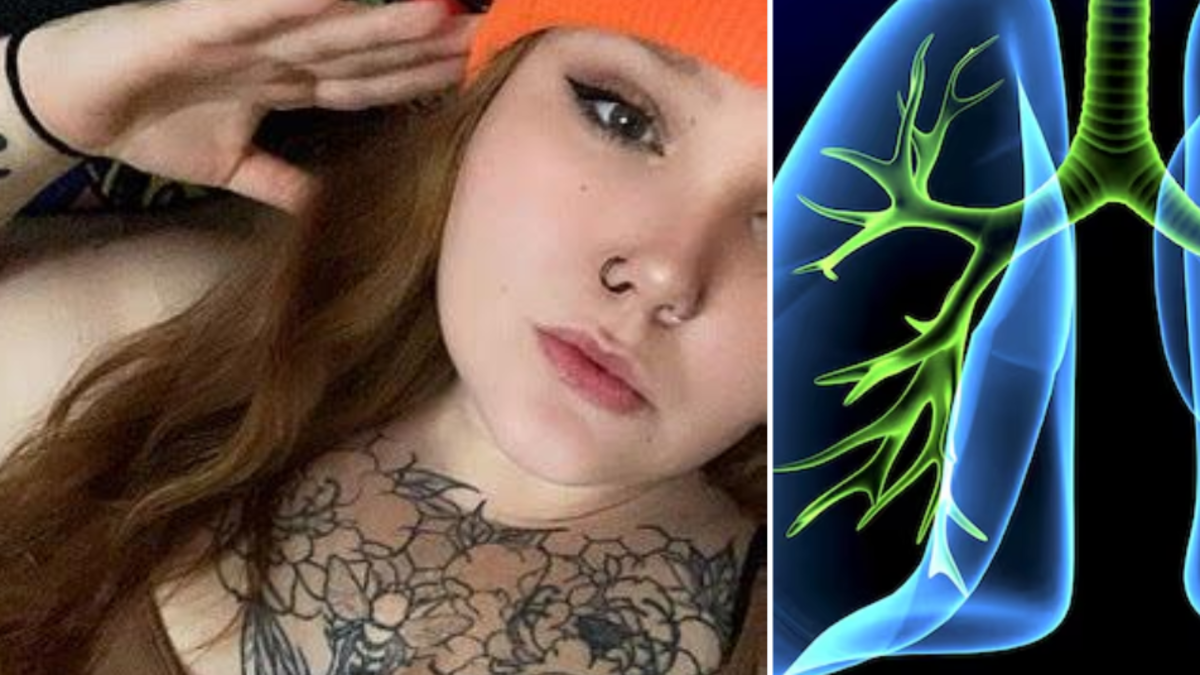 Mujer de 29 años cambió el cigarrillo por el vapeador pensando que era ‘más saludable’ y ahora tiene rara enfermedad pulmonar: ‘No sabían tratarme’