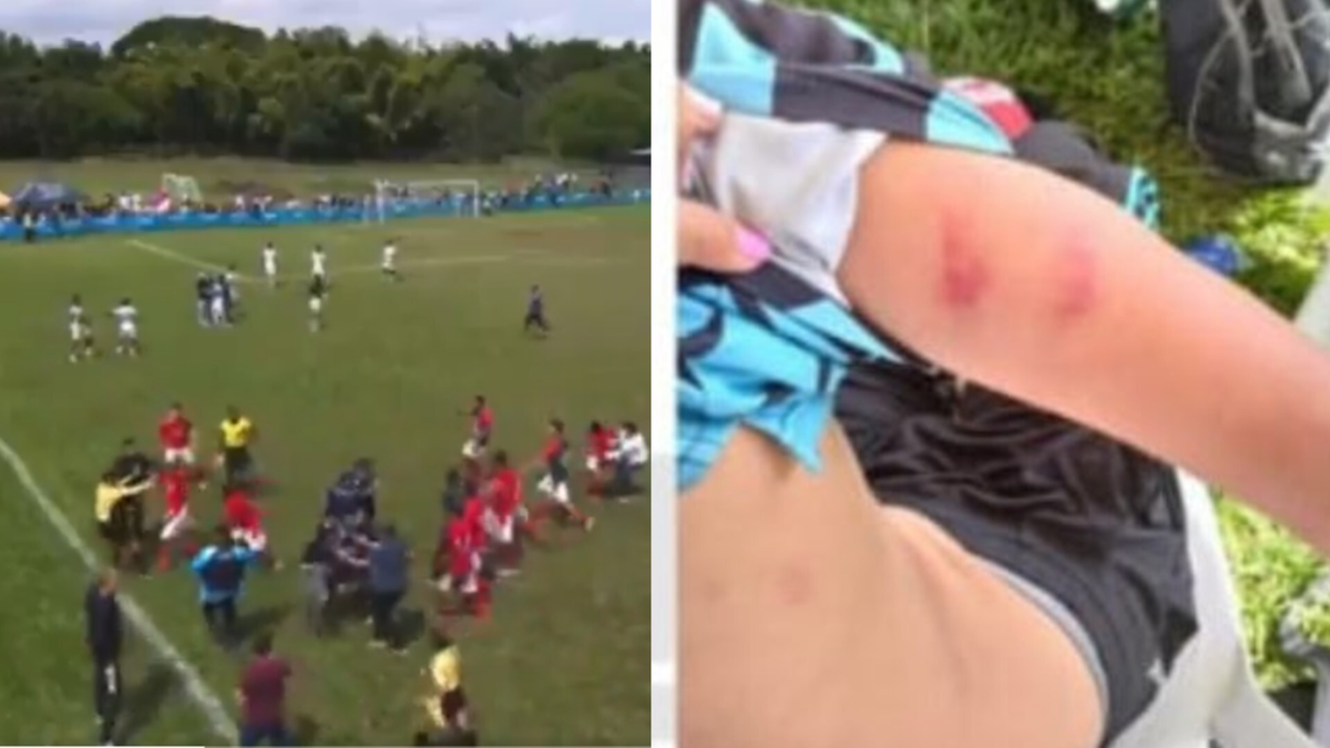 Revelan imágenes de las lesiones sufridas por árbitro tras la brutal agresión que le propinaron jugadores y miembros del América Sub-17 (video)