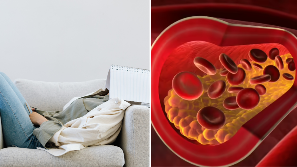 High Bad Cholesterol: Other Causes & Solutions