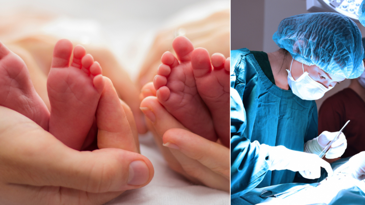 Gemelas siamesas fueron separadas en operación que duró varias horas: ‘Milagro de Navidad’