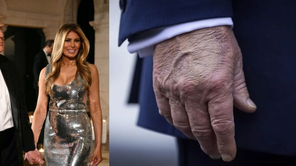 Las dudas sobre la salud de Trump resurgen tras su aparición en Año Nuevo y se perfilan como eje del debate político en EE. UU. en 2026: ¿qué se sabe?