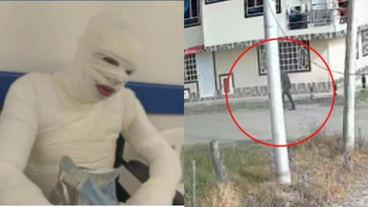 Incendio de una celda en estación de la Policía en Choachí, Cundinamarca, deja a hombre con graves quemaduras: familia denuncia irregularidades