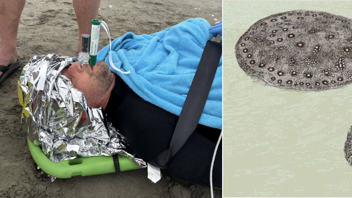 Hombre se salva de milagro tras el ataque de una raya durante un entrenamiento de rescate: ‘Lo apuñaló en el abdomen’