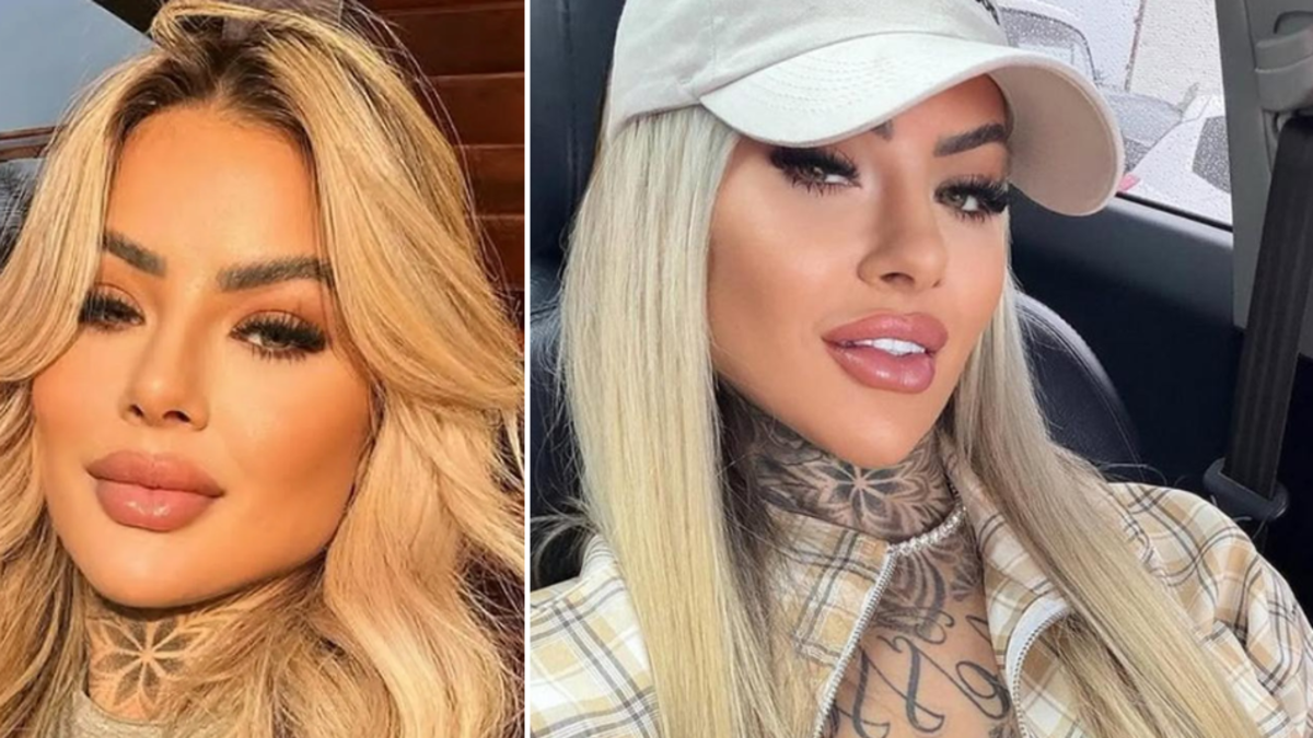 ‘Influencer’ de 27 años, madre de dos hijas, murió 18 días después de someterse a una cirugía plástica en Brasil