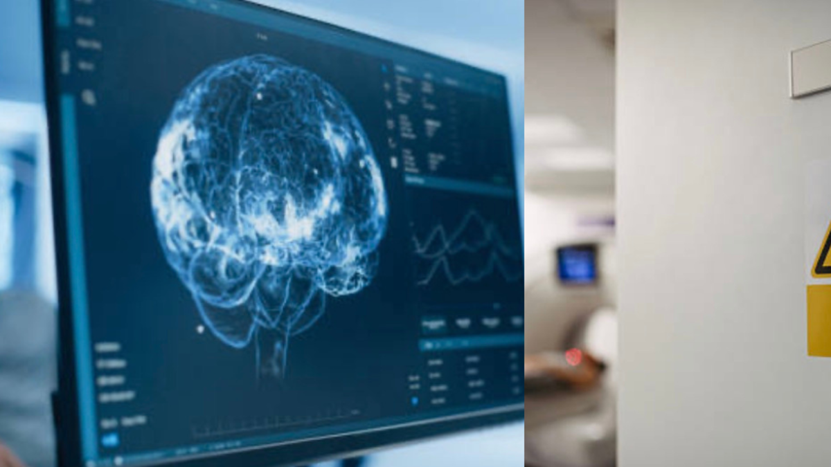 Científico se causa daño cerebral por desmitificar 'Síndrome de la Habana' con arma rusa de radiaciones