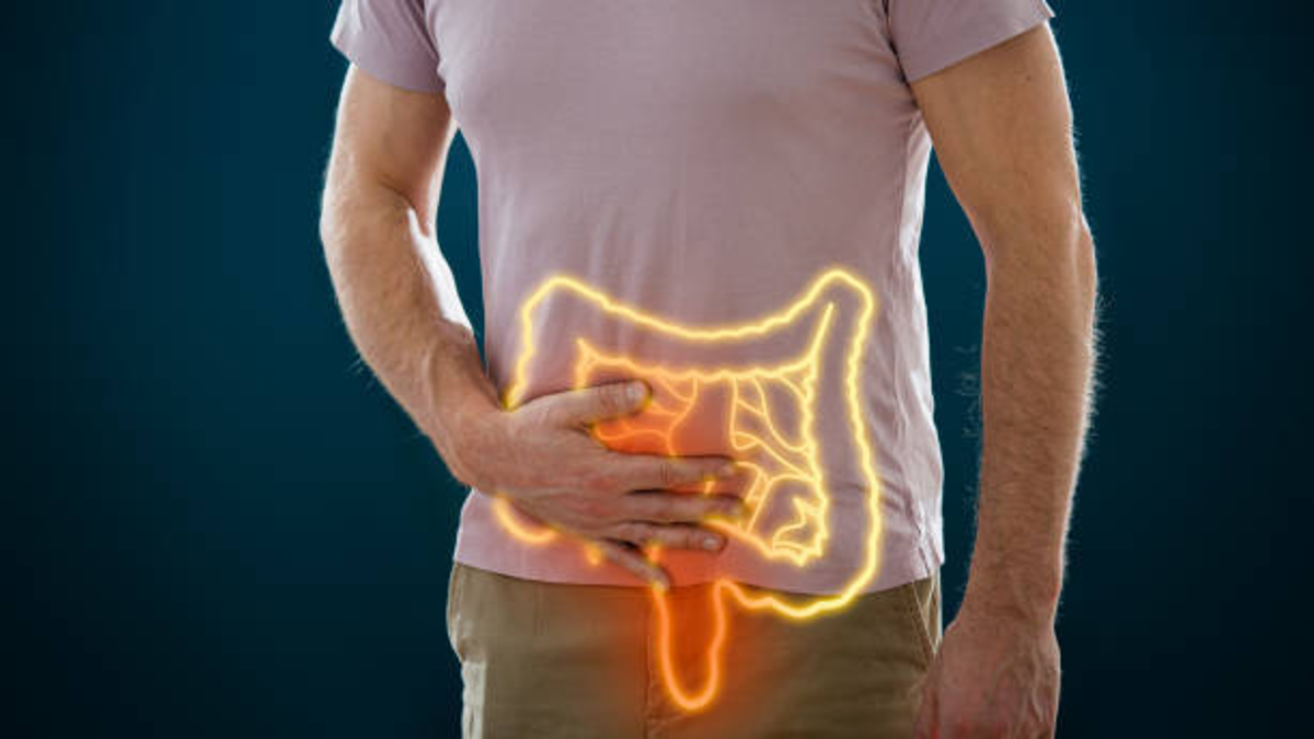 Las causas que podrían causar cáncer de colon en menores de 50 años: la ciencia busca identificar con claridad las causas