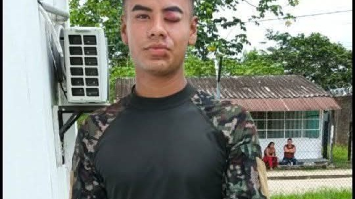 'Mamá, se cayó el avión, pero tranquila, estoy bien': el desgarrador testimonio de uno de los 57 sobrevivientes del accidente del Hércules en Putumayo