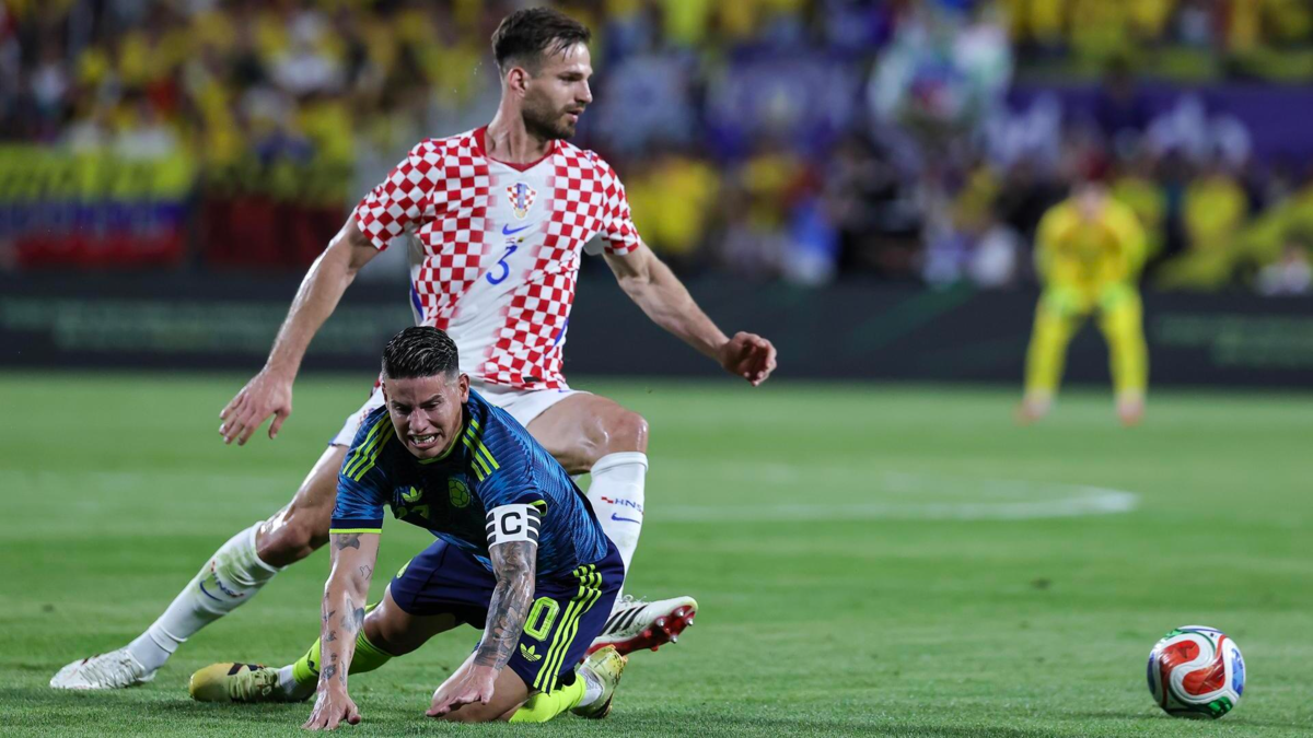 James Rodríguez: cuerpo médico del Minnesota United calificó sus registros como 'graves'