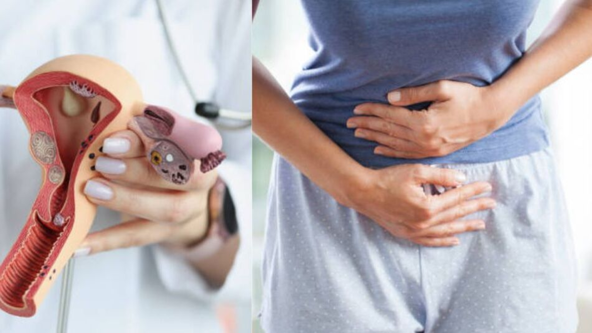 Tres señales del cáncer de cuello uterino que se pasan por alto