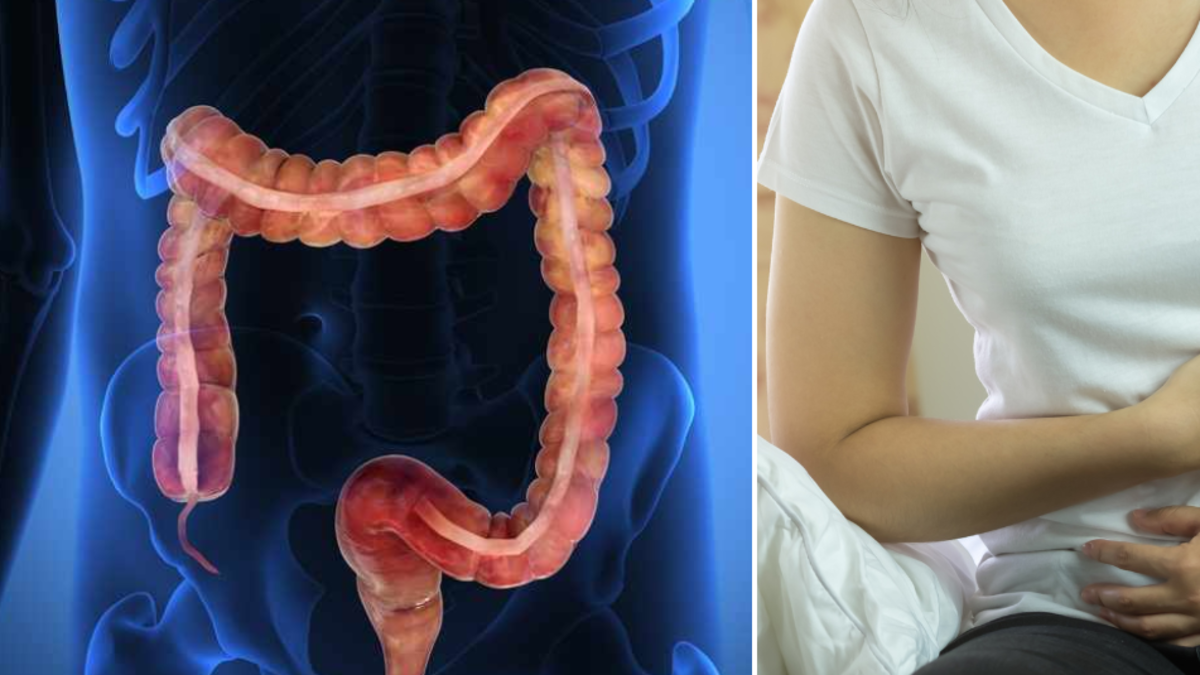 Expertos aclaran los riesgos del consumo excesivo de ultraprocesados: ¿pueden causar cáncer?