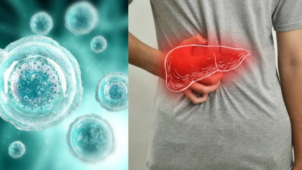 Investigadores de la Clínica Mayo identifican 'células zombi' responsables de inflamación en hígado graso