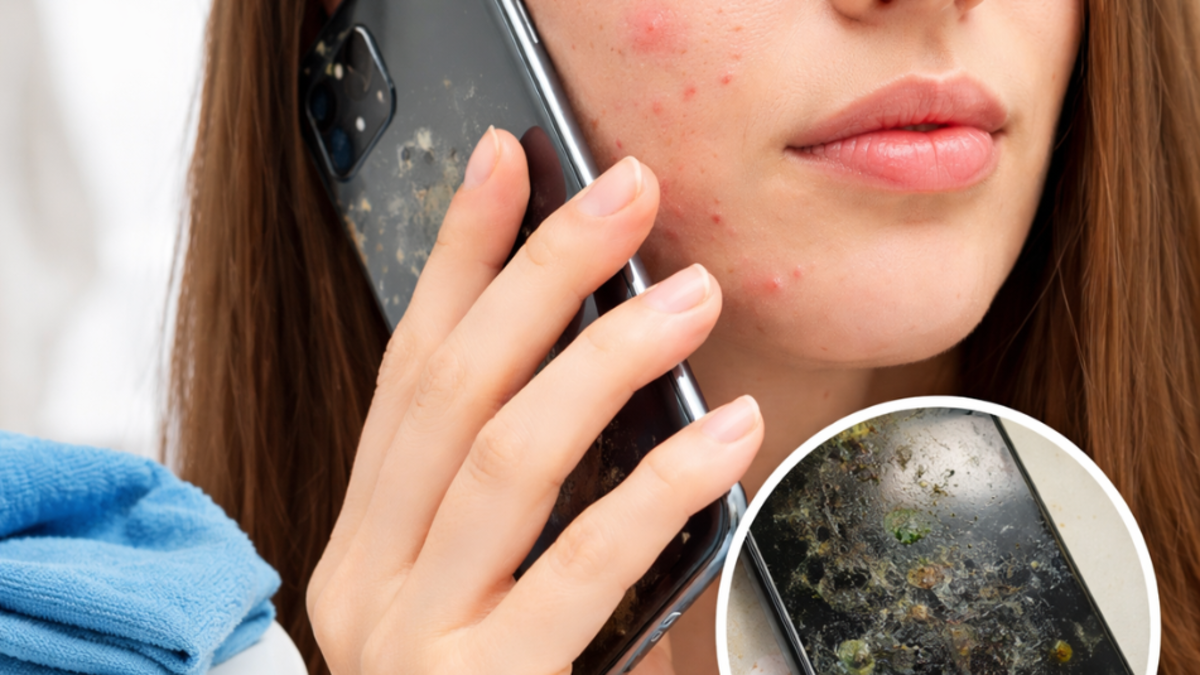 ¿Acné por el celular? El factor silencioso que puede afectar la salud de la piel por el uso de dispositivos móviles