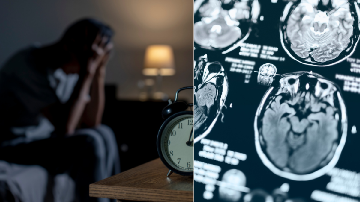 ¿Olvida lo que sueña al despertar cada mañana? Un estudio lo vincula con señales tempranas de Alzheimer