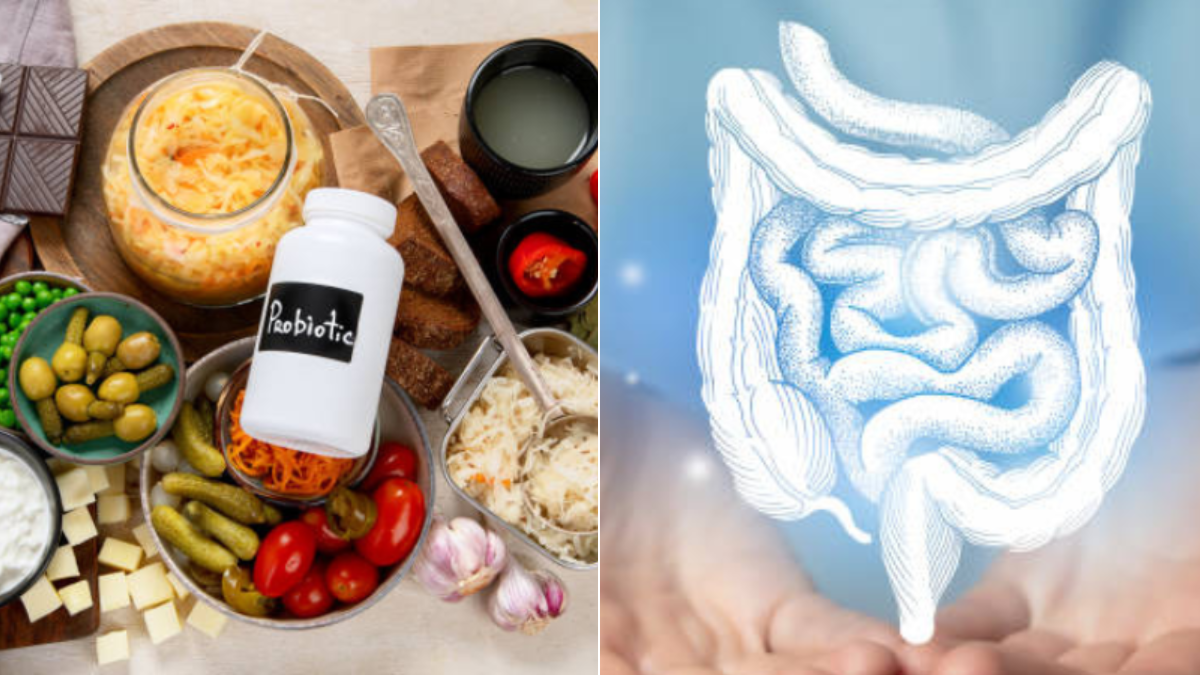 Probióticos y prebióticos: cuándo tomarlos y cómo mejoran la salud intestinal